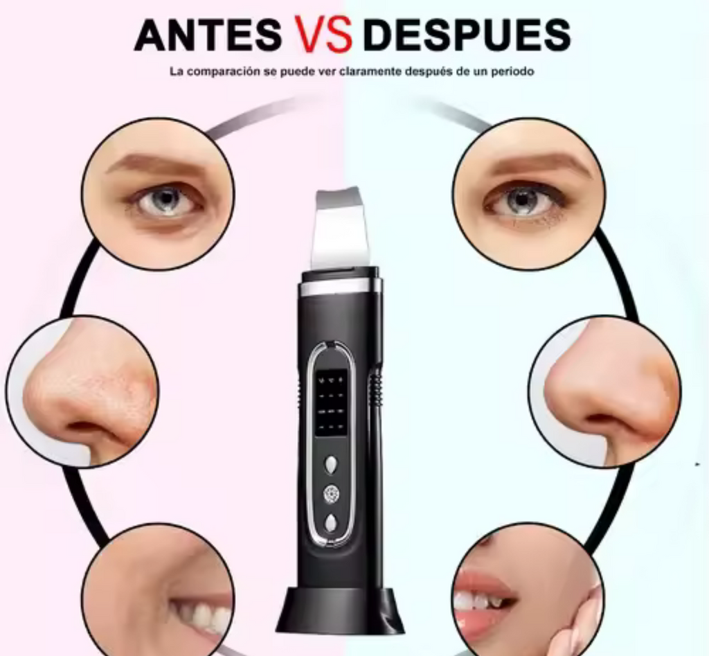 Ultrasonic Skin Scrubber & Facial Spatula (Professional Use)